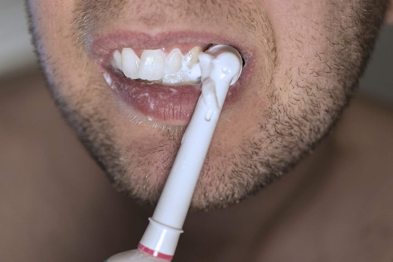 Izbjeljivanje zubi trebate li to uciniti
